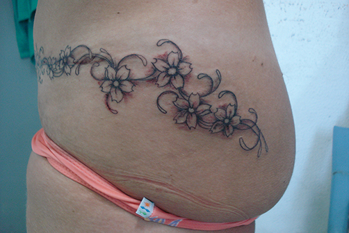 tatuagem-estetica-005