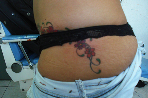 tatuagem-estetica-008