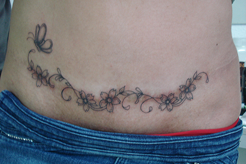 tatuagem-estetica-010