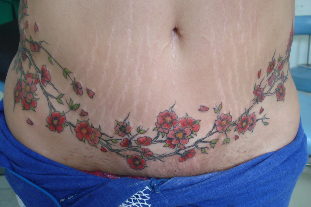 tatuagem-estetica-022